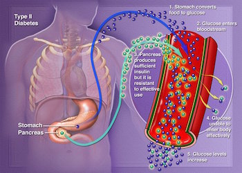 How Animal Fat Can Cause Type 2 Diabetes